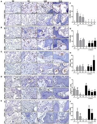 CCR2 Contributes to F4/80+ Cells Migration Along Intramembranous Bone Healing in Maxilla, but Its Deficiency Does Not Critically Affect the Healing Outcome